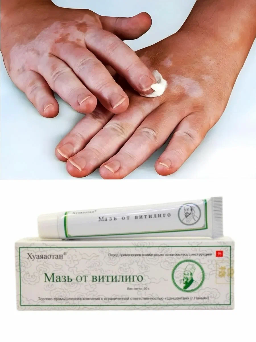 

Мазь от Ветилиго, 20 г.